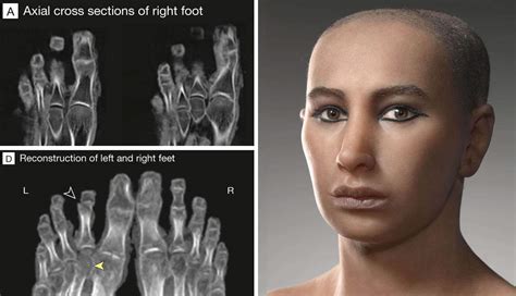 Tutankhamun Face Reconstruction