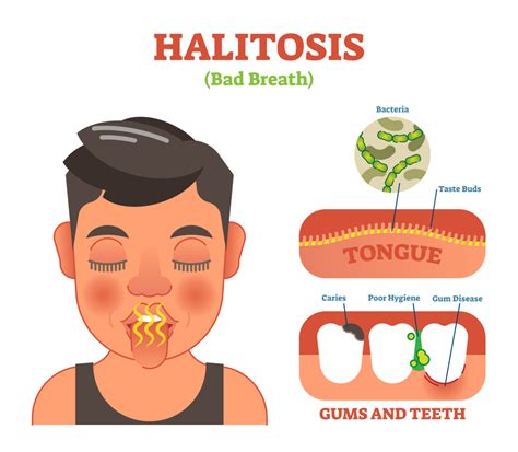 what are the causes of bad breath and how to cure bad breath