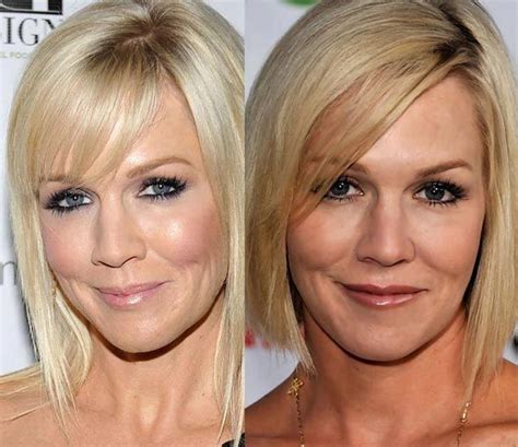 Jennie Garth Plastic Surgery Before After Botox Fillers Celebrity