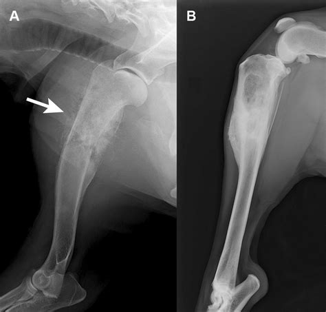 X Ray Films Of Humerus A And Tibia B Note The Trabecular Bone