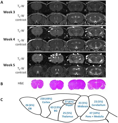 A Mri Scans Of The Whole Mouse Brain Were Initiated 3 Weeks After