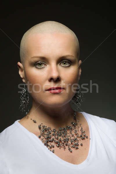 Aggregate More Than 134 Girl Without Hair Best Vn