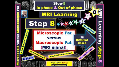 Mri Learning 8 Macroscopic Fat Vs Microscopic Fat Opposed Phase 13