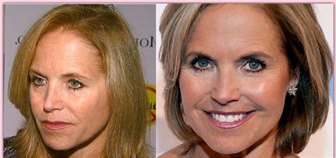katie couric plastic surgery before and after photos celeblens