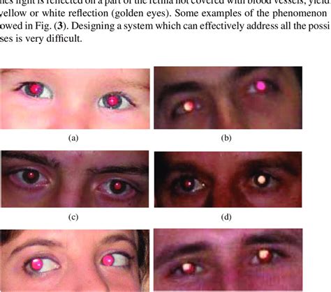 Examples Of The Variability Of The Red Eye Phenomenon Golden Eyes Are