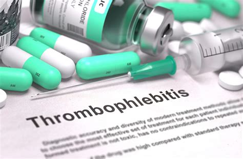Superficial Thrombophlebitis Causes Symptoms And Treatment