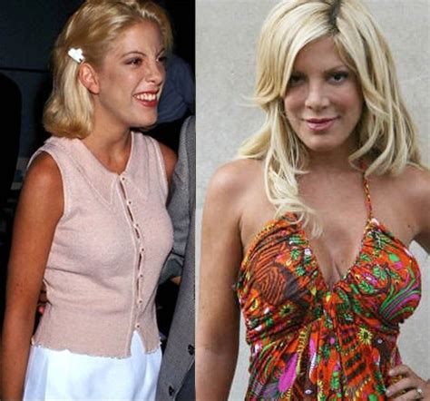 Tori Spelling S Many Plastic Surgeries And Tattoo That Matches With Her Husband Glamour Path