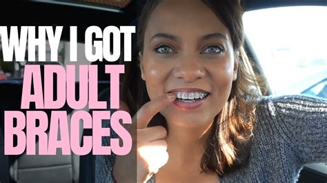 Vlog I Got Braces Cost My Dental Issues Insecurities Brittney
