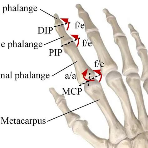 Comparison Of The Angles Of The Mcp And Pip Joints And The Misaligning