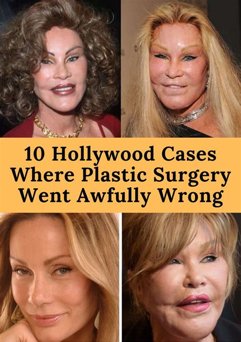 10 Hollywood Cases Where Plastic Surgery Went Awfully Wrong Celebrity
