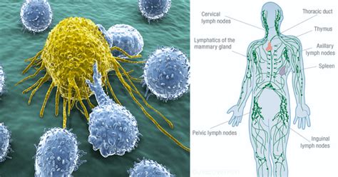 The Lymphatic System Is How Cancer Spreads Here Are 10 Ways To Keep