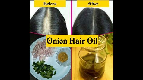 Onion Oil To Stop Hair Fall And Regrow New Hair Natural Miracle Home