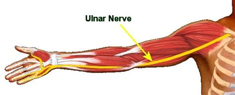 Ulnar Nerve Entrapment At The Elbow Dr Groh Artofit
