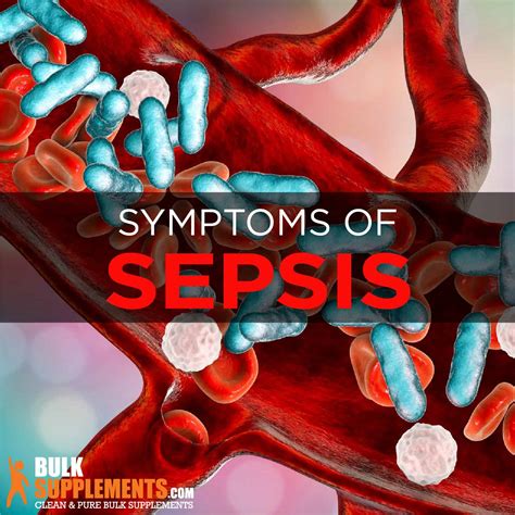 Sepsis Symptoms Causes And Treatment By James Denlinger
