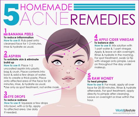 Cavsconnect Say Goodbye To Acne The Natural Way