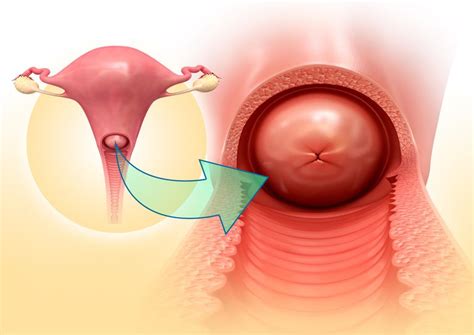 What You Need To Know About Cervix Health