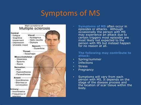 Multiple Sclerosis Powerpoint