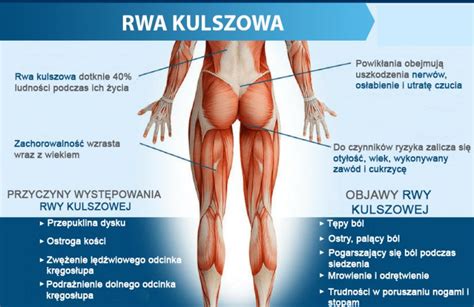 Rwa Kulszowa Objawy Przyczyny Najlepsze Sposoby Leczenia