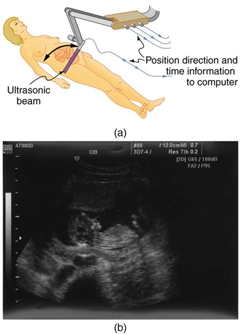 177 Ultrasound College Physics