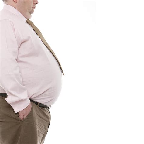 Obese Man