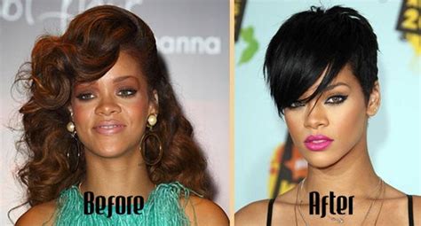 Rihanna Skin Bleaching Before And After Beyonce Skin Lightening