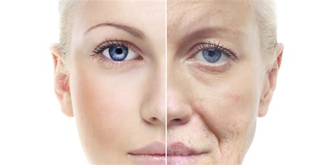 Signs Of Aging And Inflammation Cutis Laser Clinics