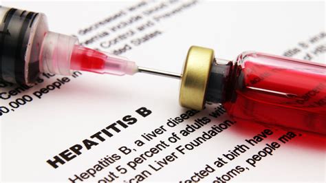 Hepatitis Qu Tipos Hay Y C Mo Diferenciarlos