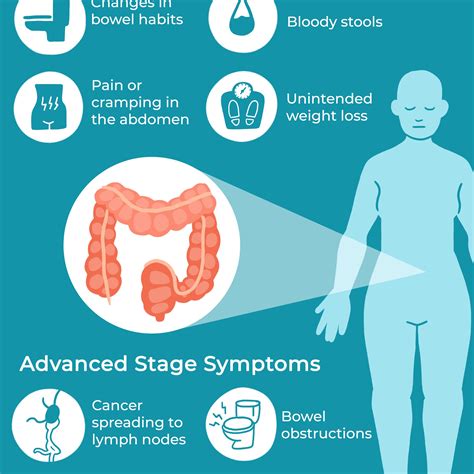 What Are The Symptoms Of Bowel Cancer Doctors Say You Should Be Aware