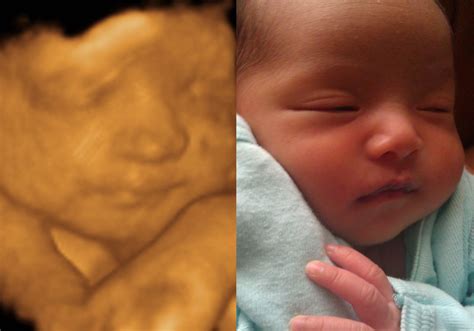 3d Ultrasound And Baby 3d 4d Hd Ultrasound Virginia