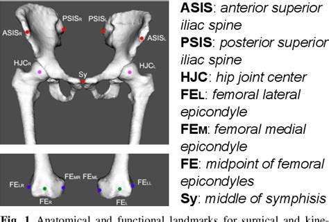 Pdf Asis Anterior Superior Iliac Spine Psis Posterior Superior