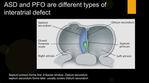 Patent Foramen Ovale Vs Atrial Septal Defect