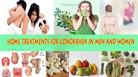 How To Deal With Gonorrhea Naturally Home Treatments For Gonorrhea In
