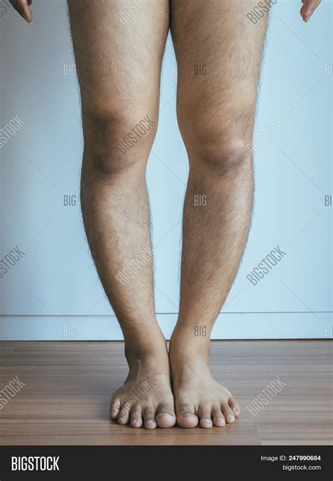 Asian Man Leg Bandy Image And Photo Free Trial Bigstock