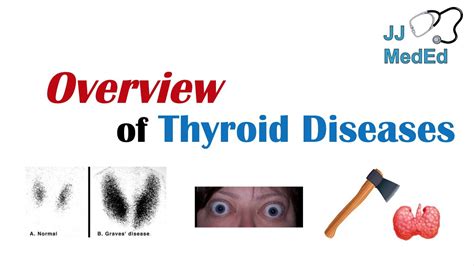 Overview Of Thyroid Diseases Hashimotos Graves Sick Euthyroid