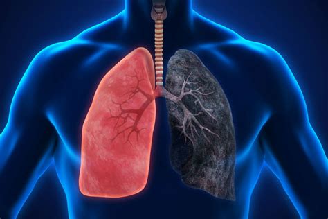 5 major differences between healthy lungs and smoker s lungs