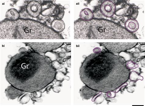 Ultrastructure Of Isolated Eosinophil Granules Ai And Bi