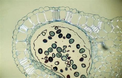 Light Micrograph Lm Transverse Section Of Dehiscence