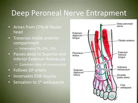 Ppt Nerve Entrapments In Runners Powerpoint Presentation Id4539042