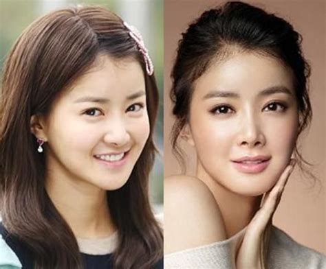 lee da hee plastic surgery pin on asian makeup zapzee