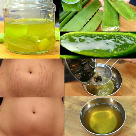 Jojoba oil works tirelessly to fade the appearance of scars and stretch marks and nurture the growth of healthy new cells. Homemade Oil For Stretch Marks | Remove Them Permanently ...
