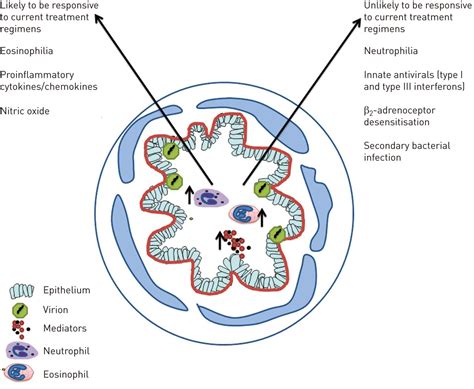 Viral Infections And Asthma An Inflammatory Interface European