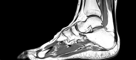 Foot And Ankle Mri I Med Radiology Network