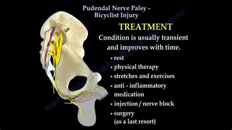 Pudendal Nerve Entrapment Syndromes Physiotherapy Treatmentexercise