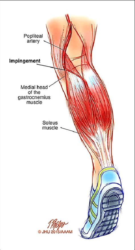 Popliteal Artery Diagram