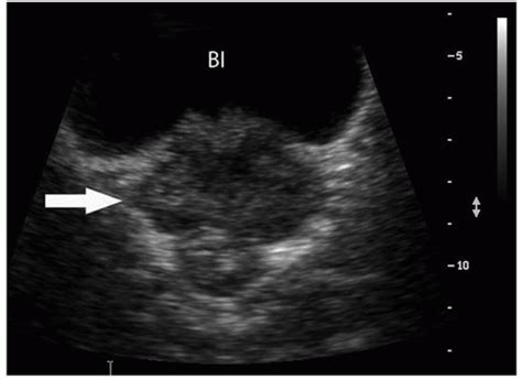 The Prostate Gland Radiology Key