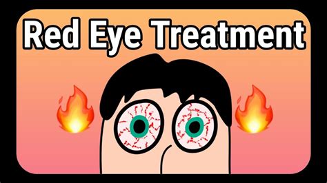 Red Eye Treatment Explained How To Get Rid Of Red Eyes Youtube