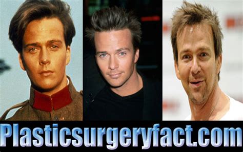 Sean Patrick Flanery Plastic Surgery Before And After Plastic Surgery