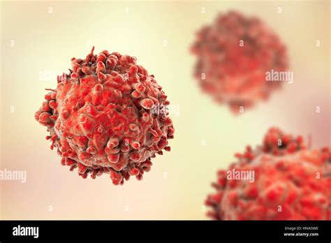 Computer Illustration Of A Cancerous White Blood Cell In Leukaemia