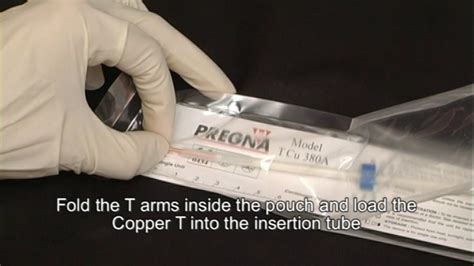 It's one of five alternative contraceptive methods that i recommend in my book period repair manual. 1 Loading Copper T 380 A - YouTube