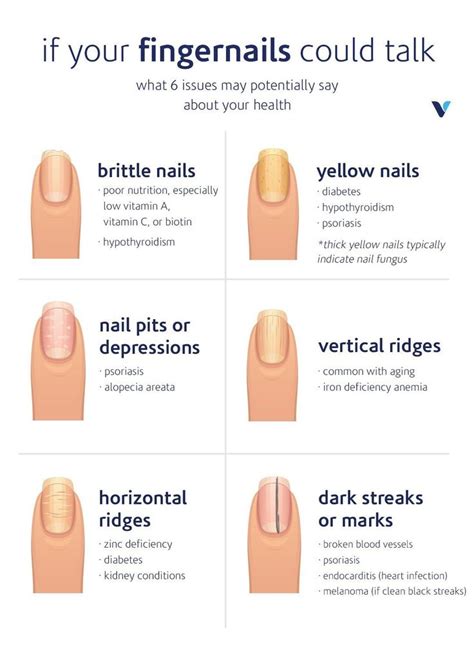 What Your Fingernails Say About Your Health Whats Good By V Fingernail Health Healthy
